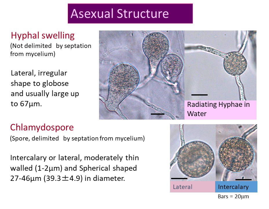   Phytophthora chrysanthemi  (ex-type nbsp; GF749 - Kageyama) asexual phase, hyphal swellings, and chlamydospores; slide provided by Koji Kageyama and Meherun Naher,nbsp;Gifu University, Japan 
